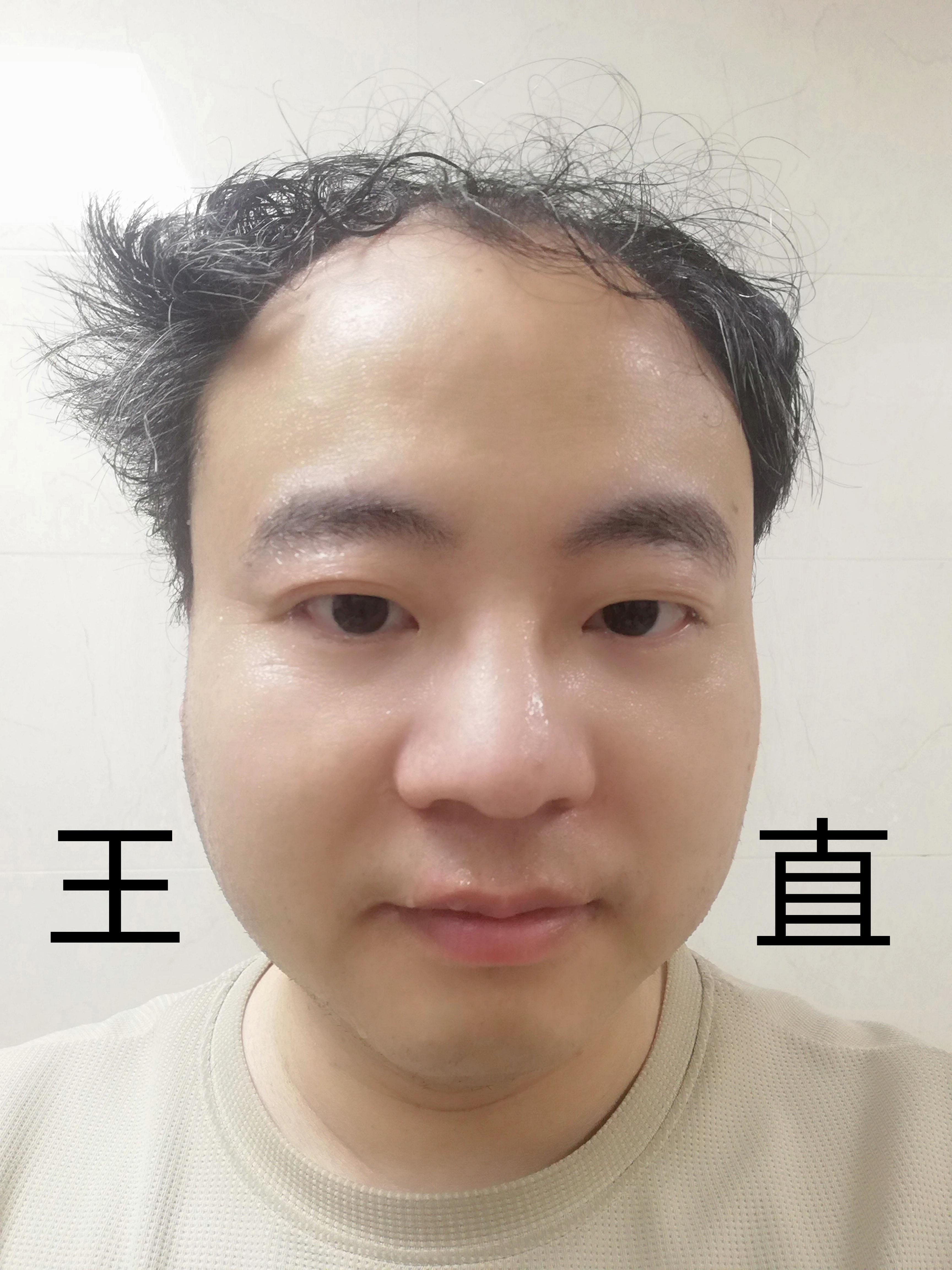 王朝阳